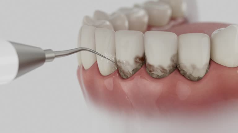 Trusted Invisalign Clear Aligners service in Logansport, IN - Dentist Open Now